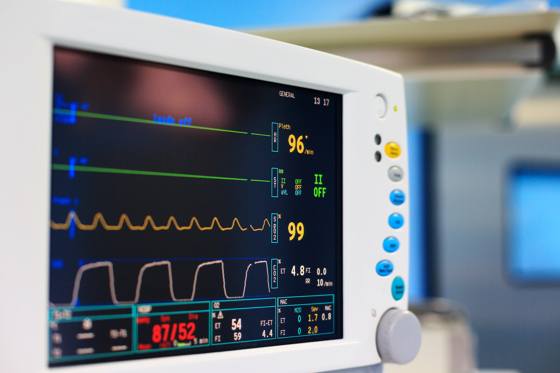 Monitor bei Operation