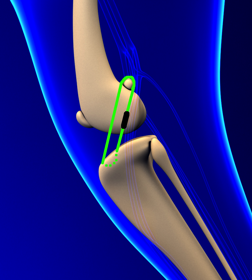 Dissertation definition picture
